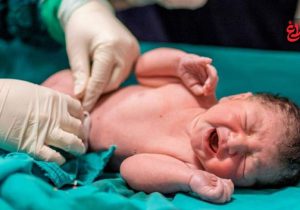 «آغازی نو برای زندگی، با زایمانی طبیعی»