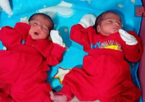 تولد دوقلوهای «مرکز نفس» در آمل